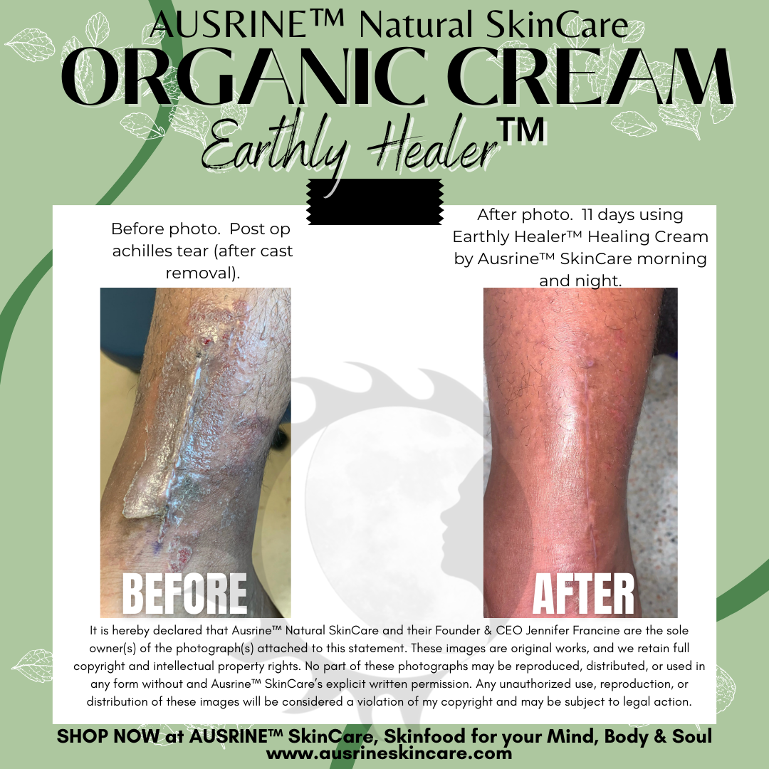 Earthly Healer™ Ultra-Calming Healing Cream
